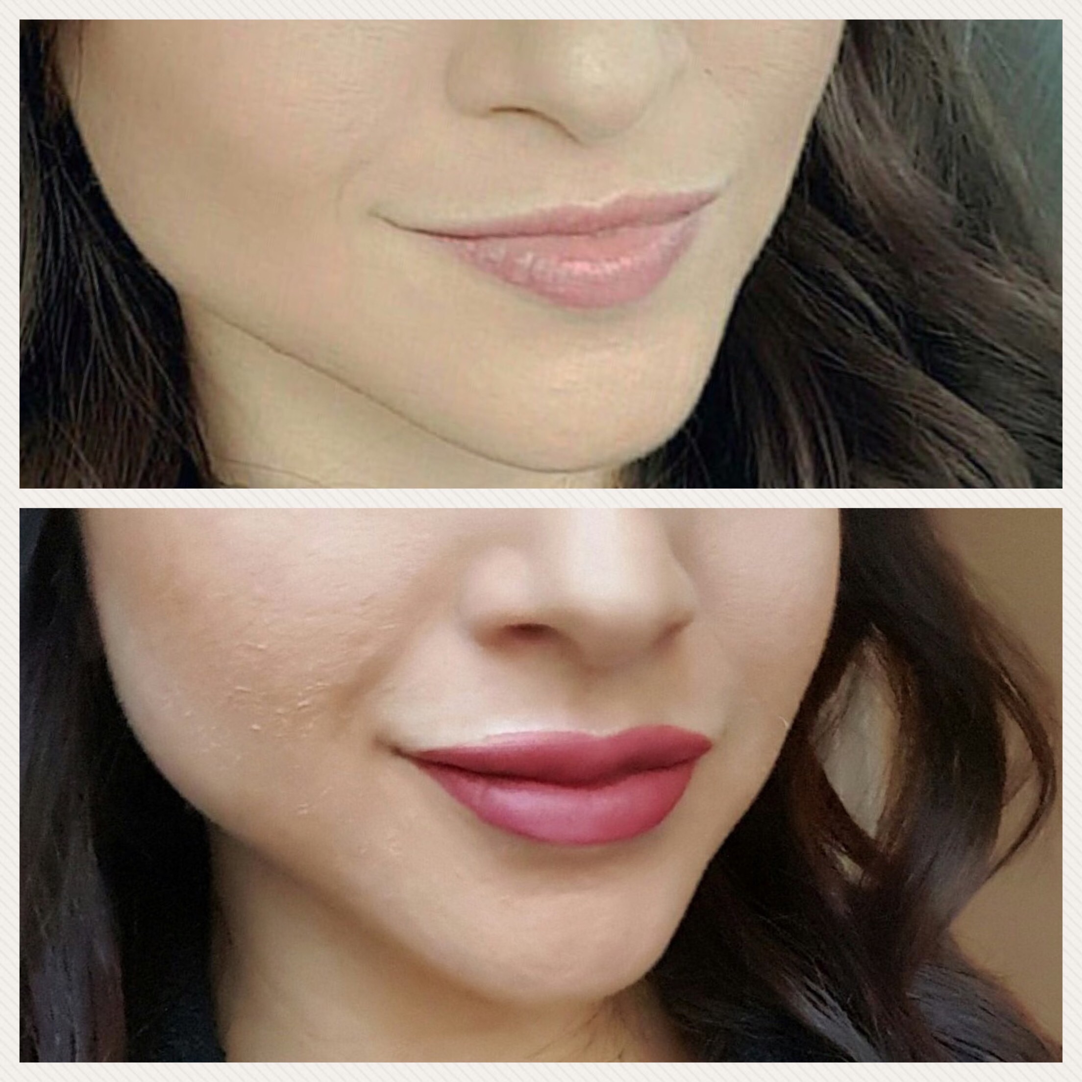 Lips-before-and-after-Juvederm-Ultra18-1